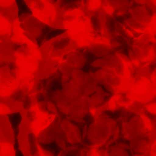 Variation 5
