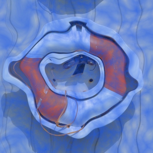 Variation 1