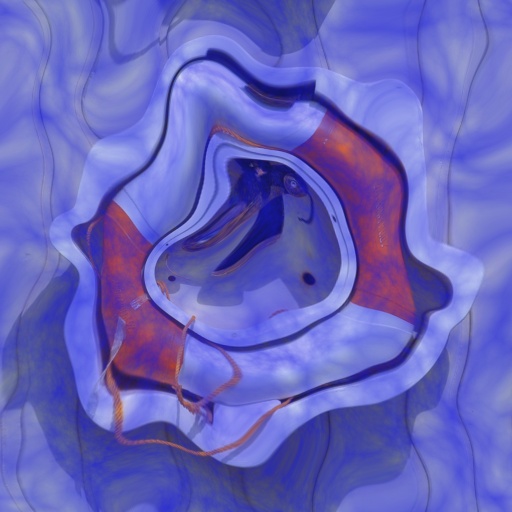 Variation 6