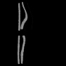 chromosomes