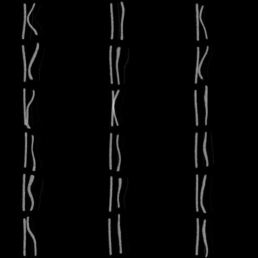 Variation 3