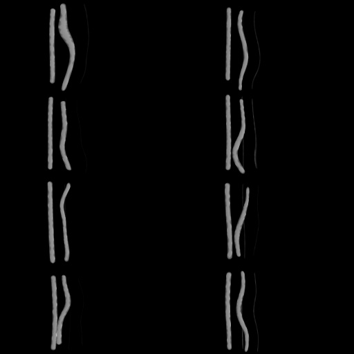 Variation 6