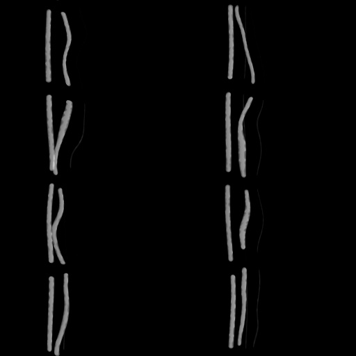 Variation 7