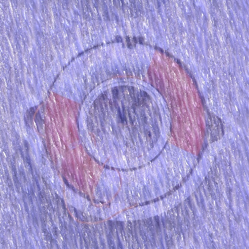 Variation 4
