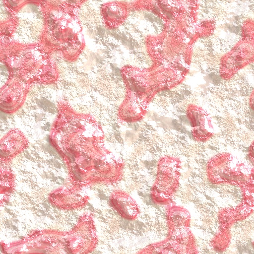 Variation 1