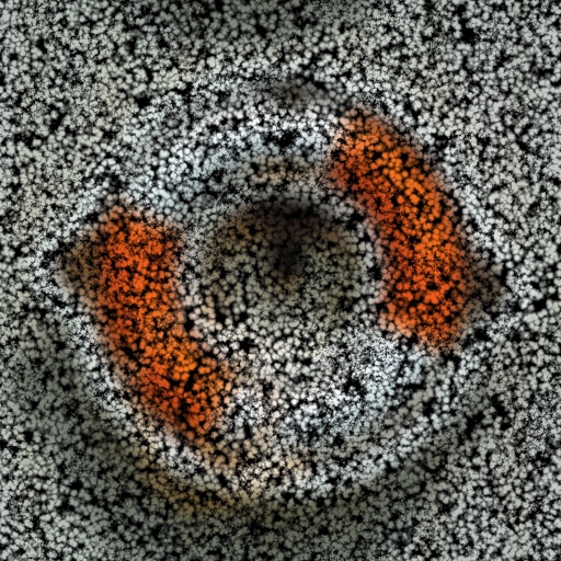 Variation 1