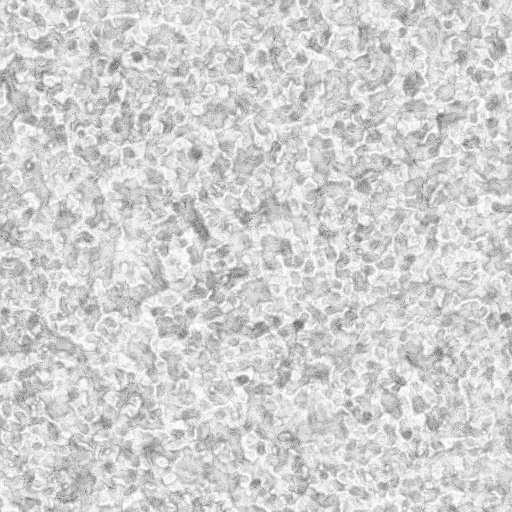 Ambient Occlusion Map
