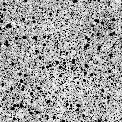 Ambient Occlusion Map
