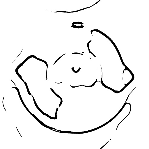 Variation 6