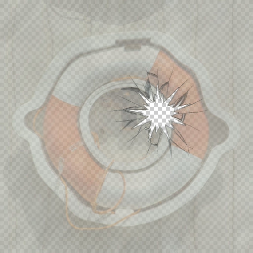 Variation 1