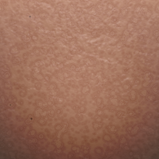 Variation 7