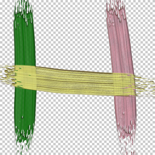 Variation 6