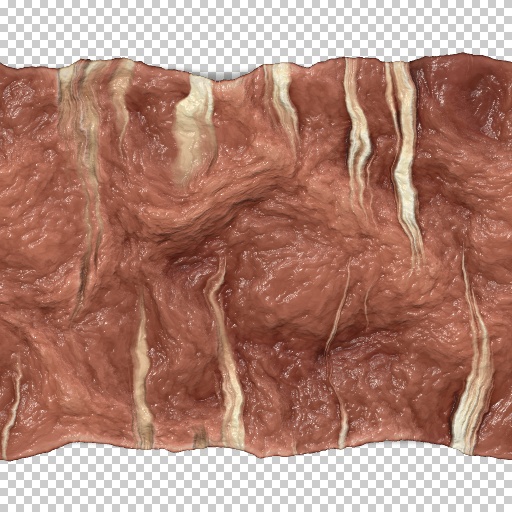 Variation 3