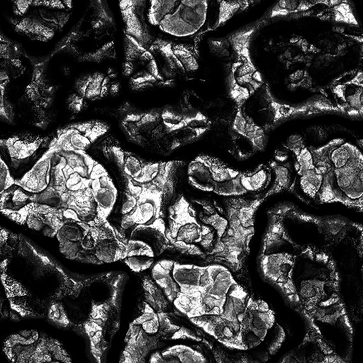Ambient Occlusion Map