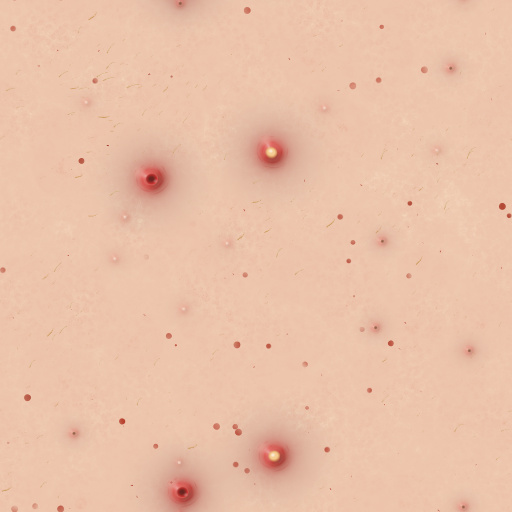 Variation 2