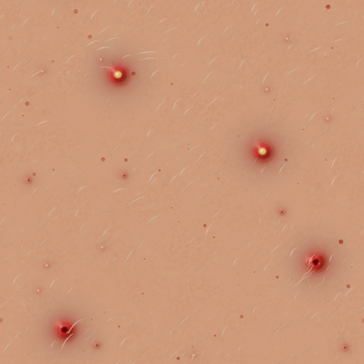 Zitstorm (Texture)