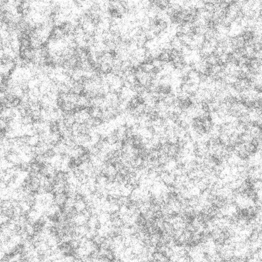 Bump Map
