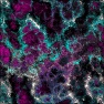 EMP