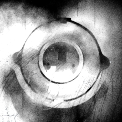 Variation 7